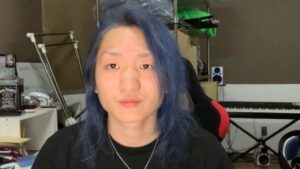 公表＆経過実況！DJ社長の整形にかかった費用や変化を徹底調査！